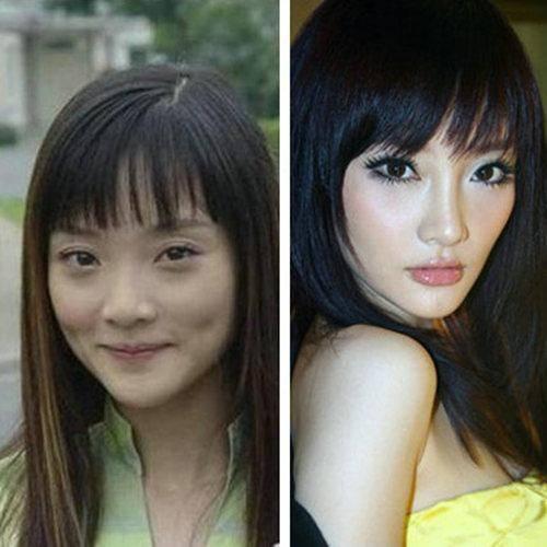 整容失败照片明星,从美丽梦想到心酸现实